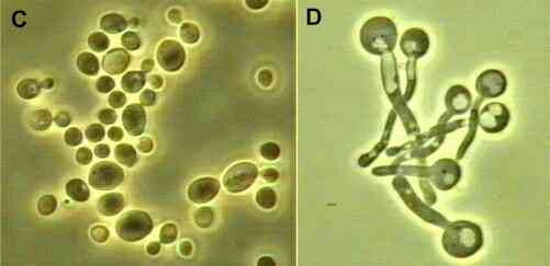 Candida Albicans Figures C D