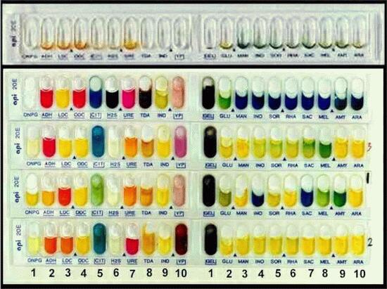 Api 20e Color Chart