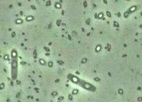 transzgenikus baktérium toxin bacillus thuringiensis