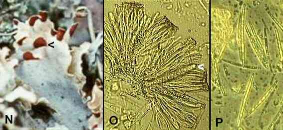 foliose lichen under microscope