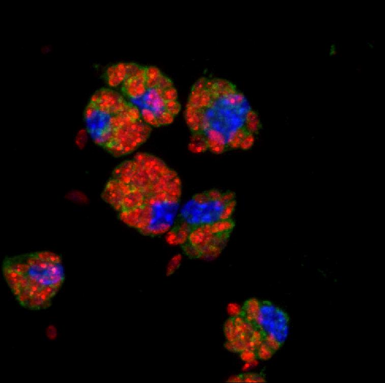 Confocal